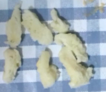 薯条