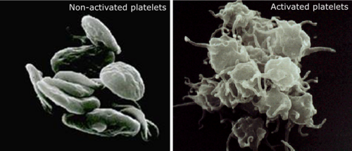 Platelets.png